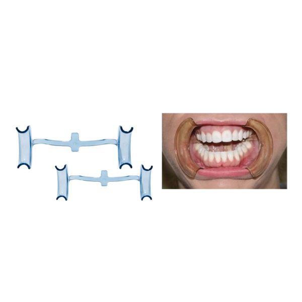 Ecarte-lèvres : DENTAL PACIFIC