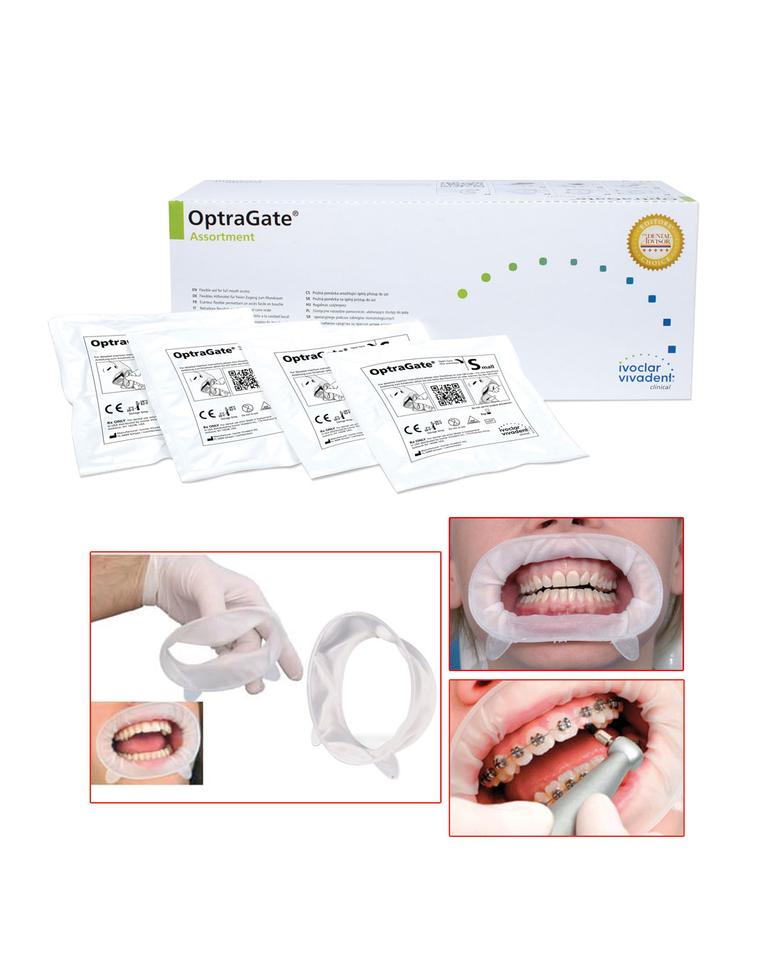 Ivoclar Vivadent OptraGate 3D Lip & Cheek Retractor – Assortment 80/Box (577275)